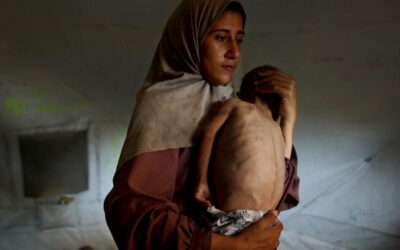 In Gaza, ‘the need to catch up to an enormous lack’ of food imposed by the Israelis