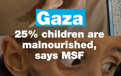 Gaza: 25% children are malnourished, says MSF