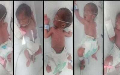 Karachi couple welcomes quintuplets in rare birth