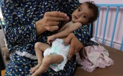 25% of young children now malnourished in Gaza, charity says, as PM vows to evacuate ‘critical’ medical cases