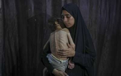 UN declares famine in Gaza City, the first in Middle East history
