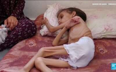 Amnesty International says Israel deliberately starving Gaza’s Palestinians