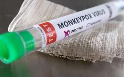 New monkeypox case detected in Pakistan