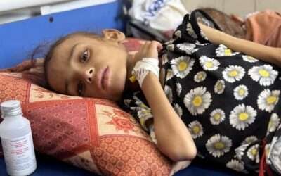 Remaining hospitals in Gaza overwhelmed with malnutrition cases