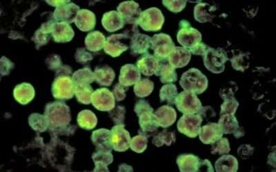 Naegleria claims another life in Karachi, toll hits five in Sindh