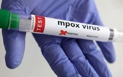 First Mpox case confirmed in Lahore as 48-year-old liver transplant patient tests positive